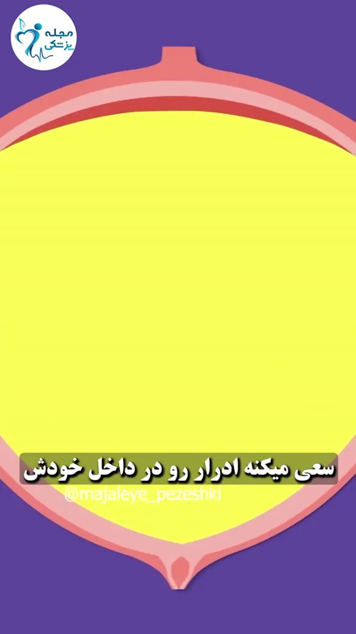 خطر نگه داشتن ادرار 