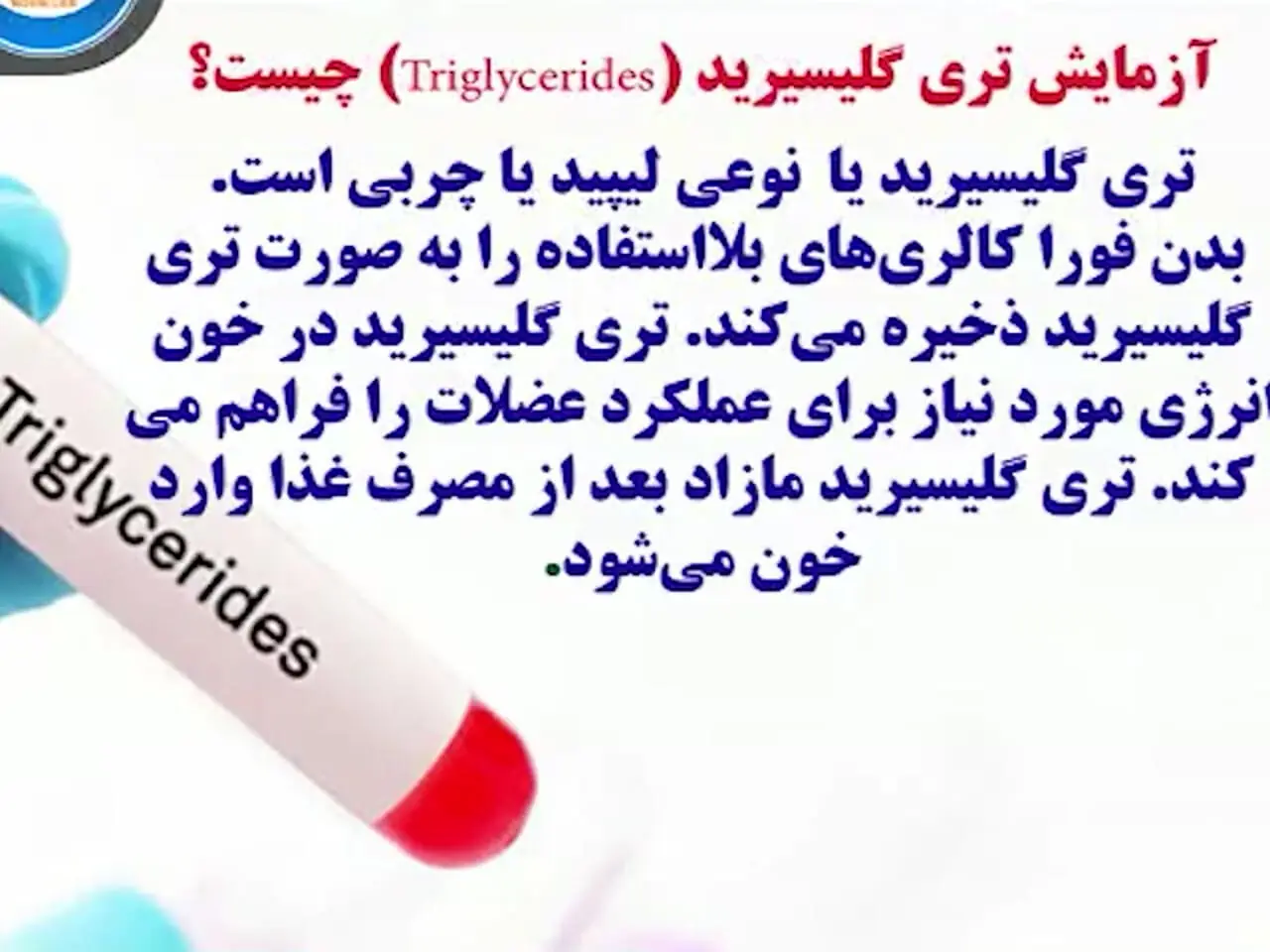 triglycerid چیست؟+ فیلم 