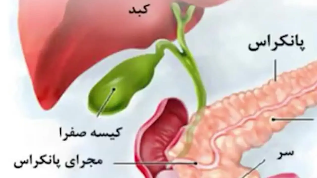 سرطان پانکراس چیست؟ + فیلم 