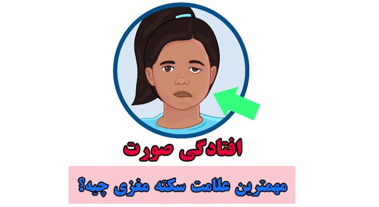 سکته مغزی چیست؟ + فیلم