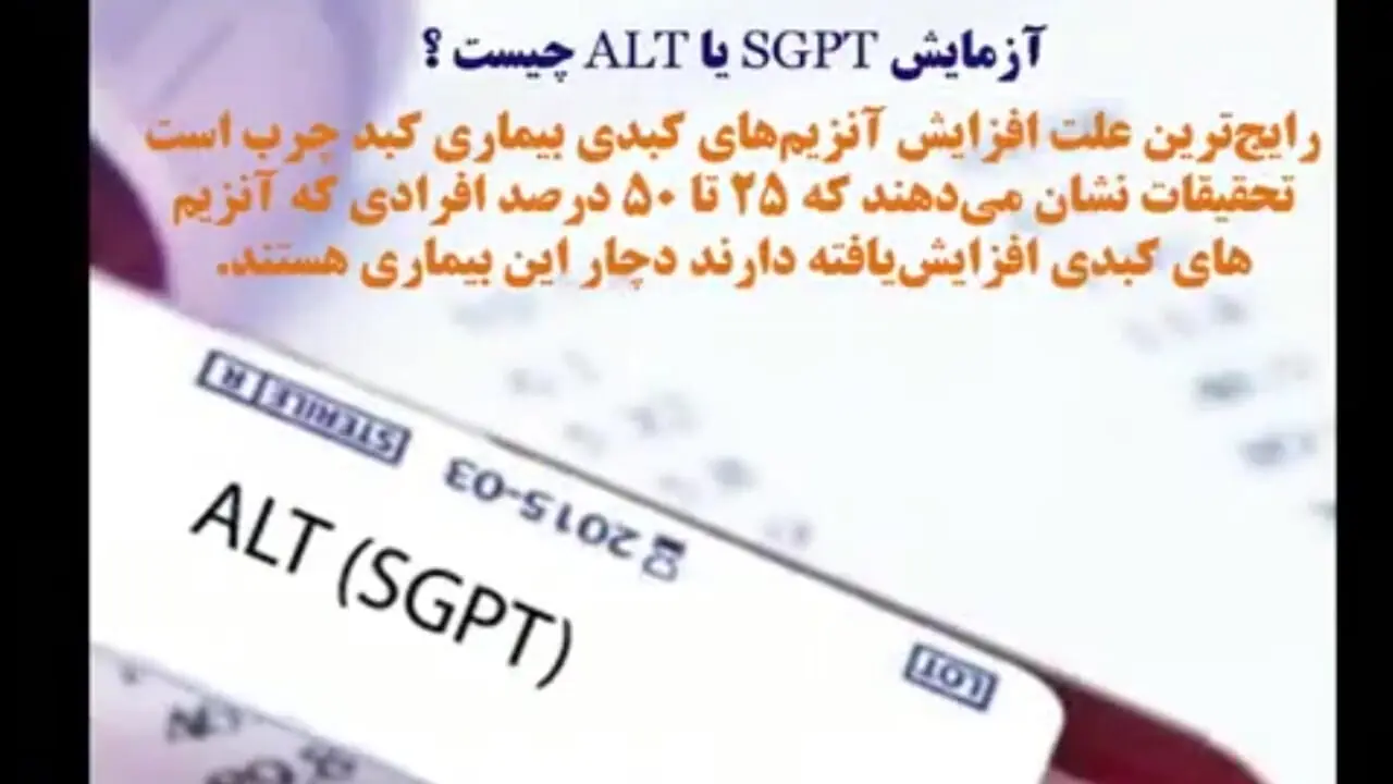 sgpt alt در آزمایش خون چیست ؟+فیلم