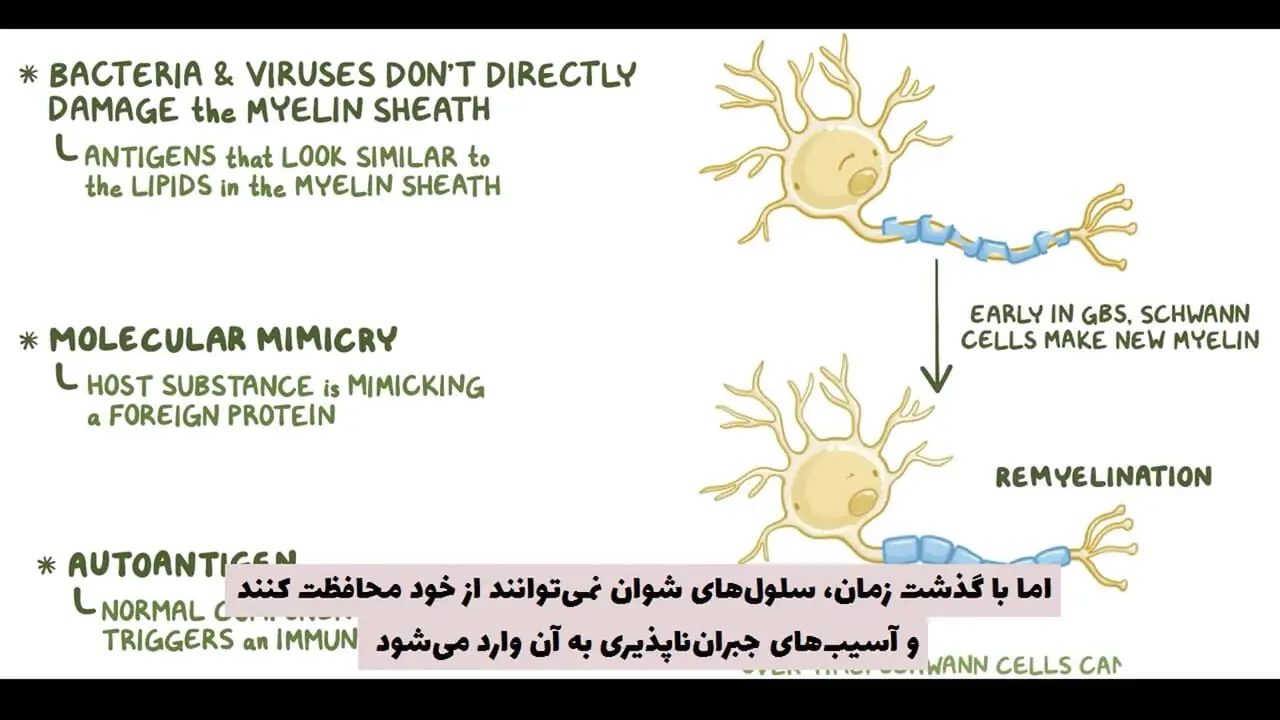 گیلن باره چیست ؟ + فیلم 