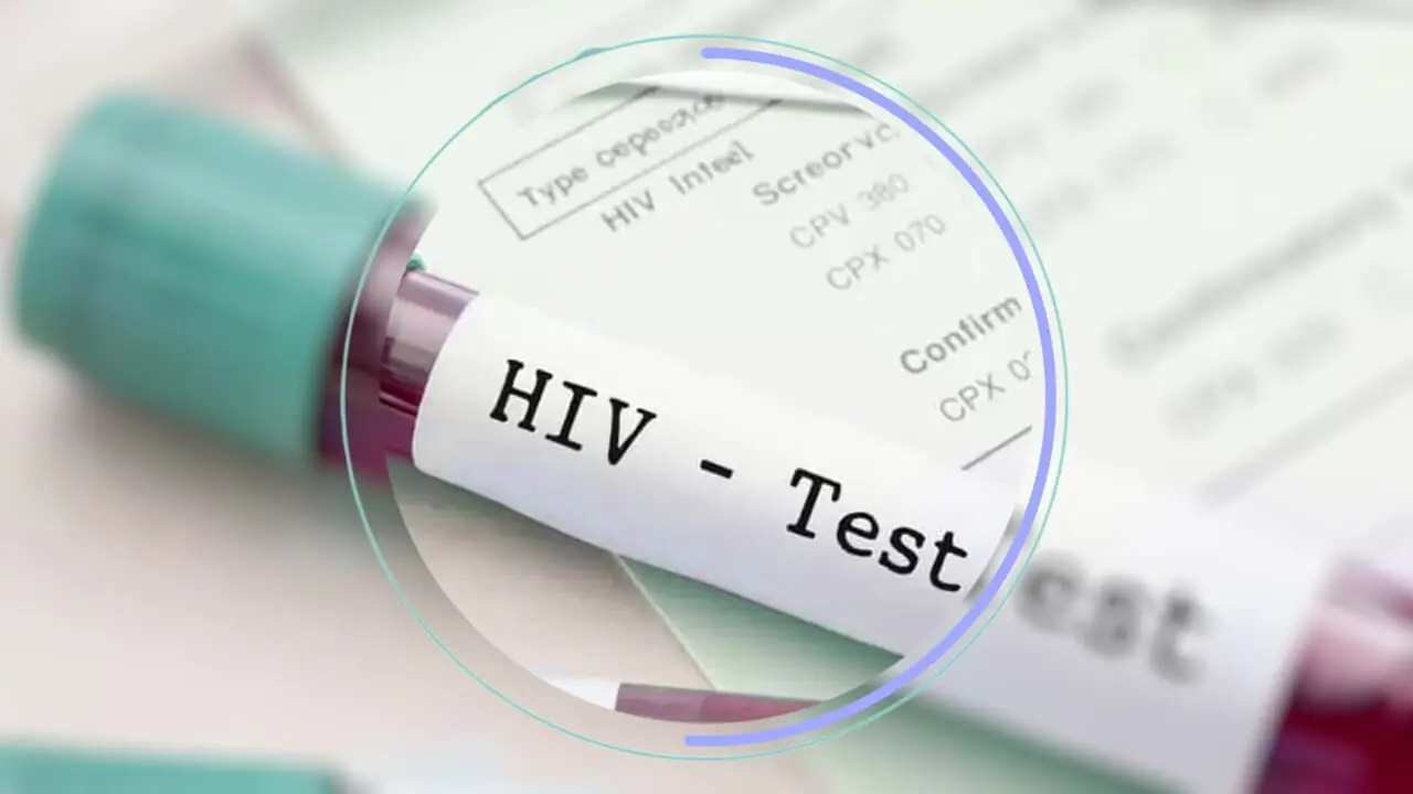 hiv ab چیست؟ + فیلم