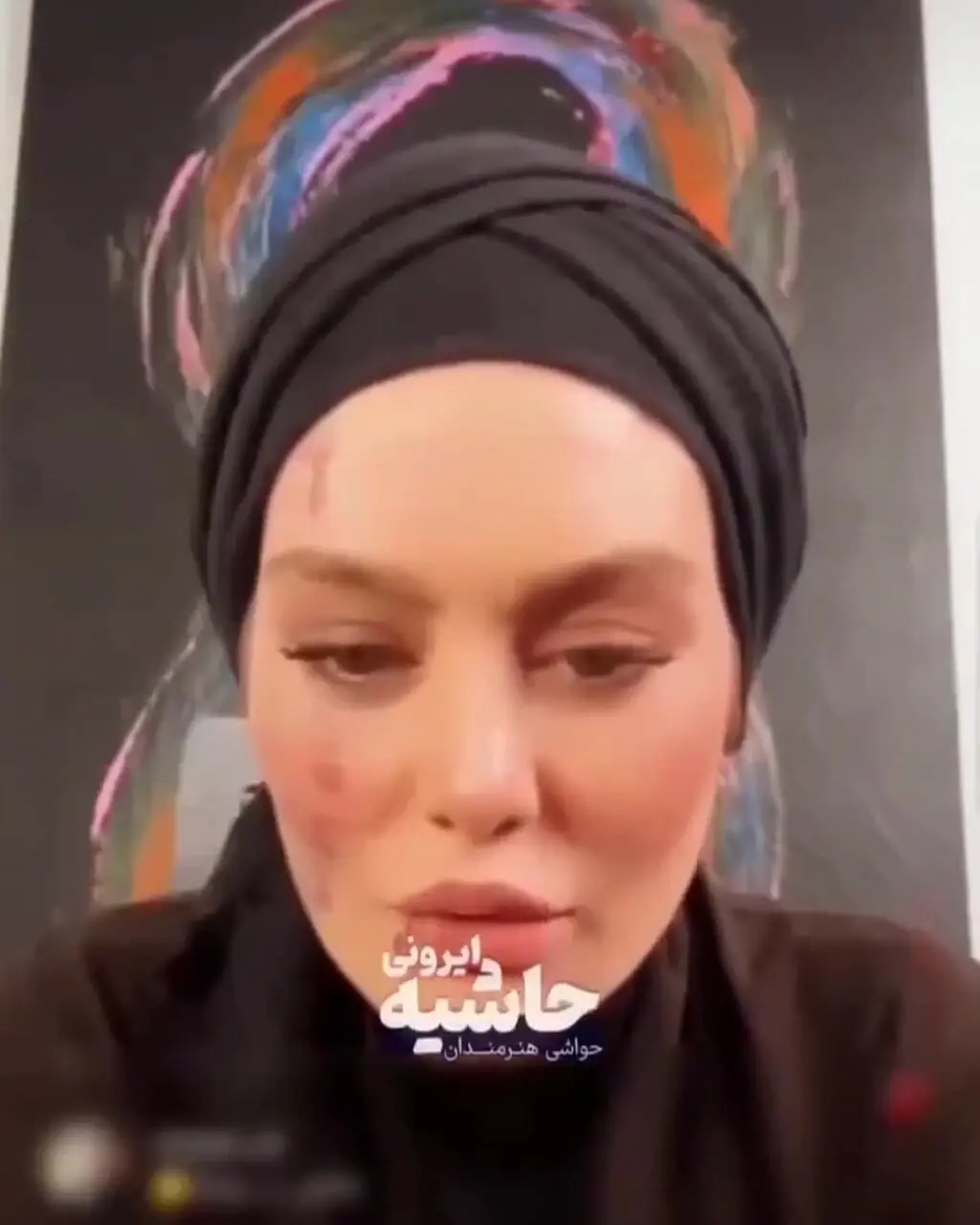فیلم شاخ دربیار / سحر قریشی : من فقط یکبار ازدواج کردم ! سحر قریشی چی به روز صورت زیبا و صافش آورده ! / حیف اون چهره ای که حالا اینجوری خرابش کرده!؟