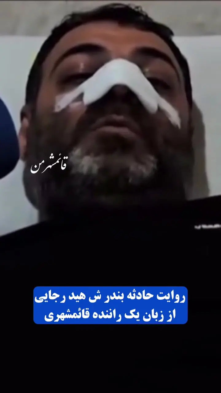 نجات معجزه آسای یک مرد در فاصله 50 متری محل انفجار بندرعباس ! / فقط دستانم را جلوی صورتم گرفتم !