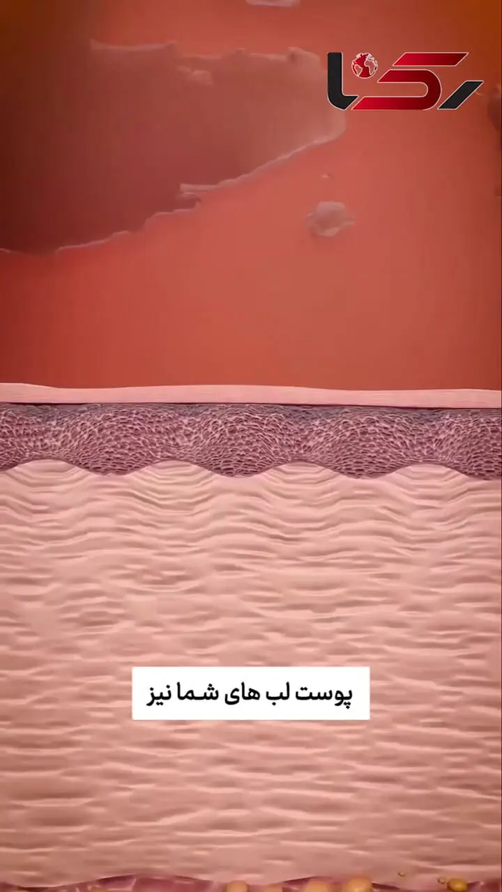 حقایق جالب درباره خشکی لب ها