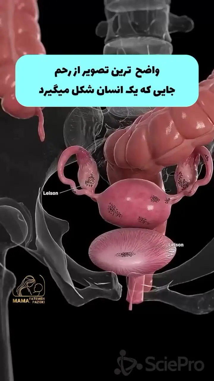  واضح ترین تصویر از رحم و تخمدان 