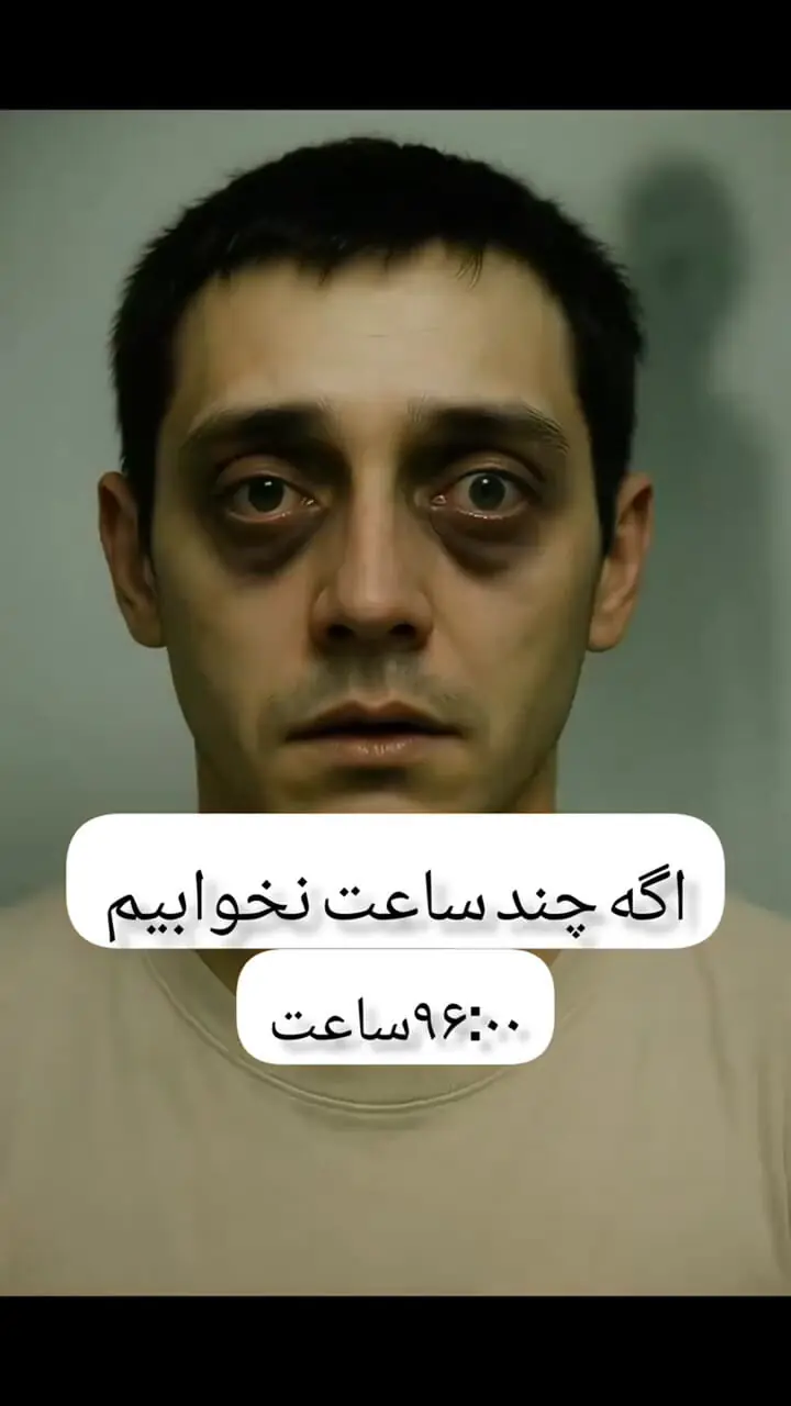  تاثیر کم خوابی بر چهره براساس میزان ساعت کم خوابی 