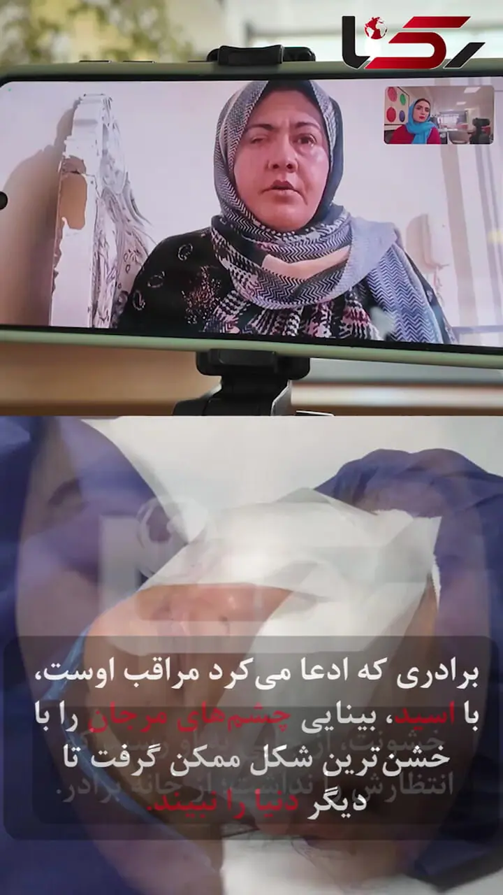 برادر در چشمان خواهر اسید ریخت تا سر کار نرود!/ این زن به کمک ما نیاز دارد + فیلم