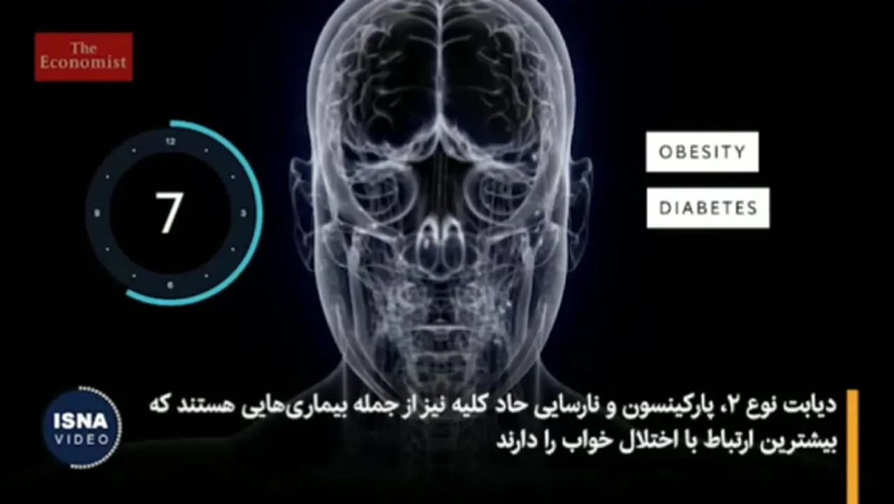 خواب نامنظم چه بلایی بر سر بدن شما می‌آورد؟