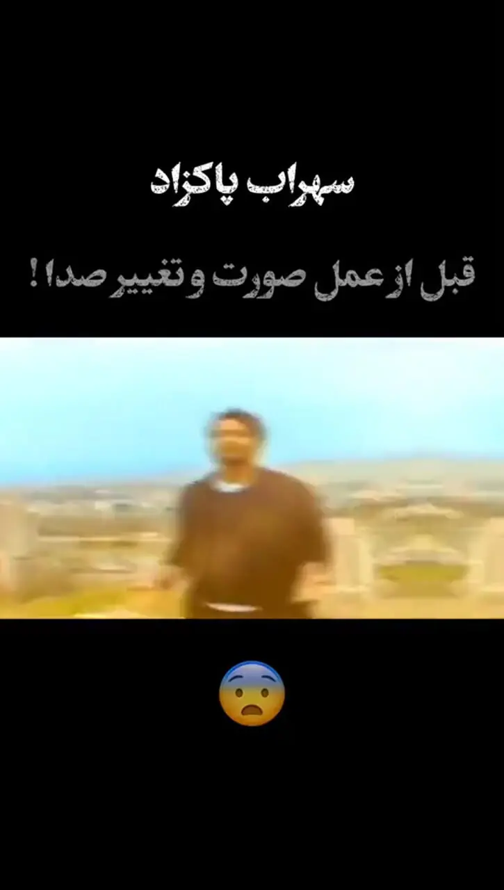 فیلم/ نگاهی به تغییر چهره و صدای سهراب پاکزاد؛ خواننده پرطرفدار/ عملهای زیبایی چیکار کرده با صورت ایشون!