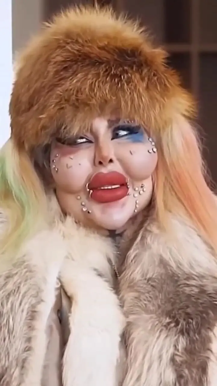 بازدید میلیونی فیلم ادعای زن ایرانی با 388 بار عمل زیبایی که در گینس ثبت شد / دکترا گفتند سه روز بیشتر زنده نمیمونم