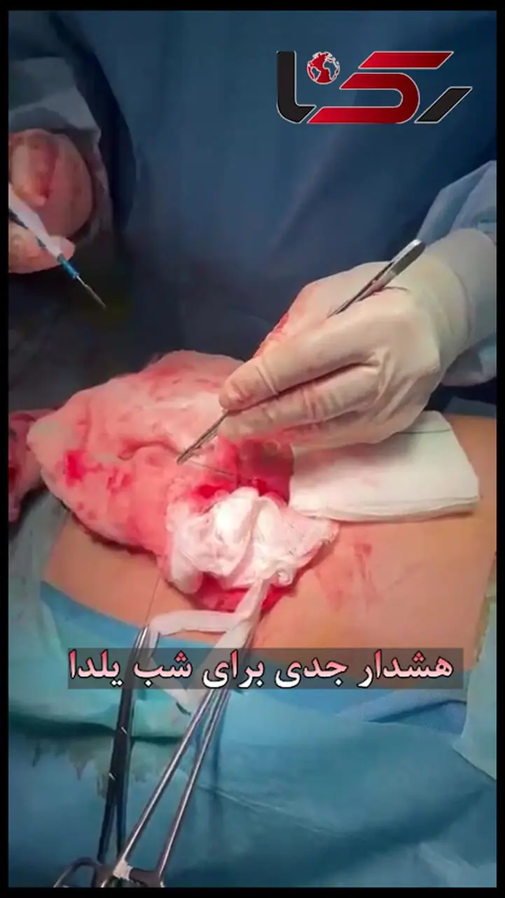 هشدار جدی برای شب یلدا / این میوه را همراه انار نخورید + فیلم