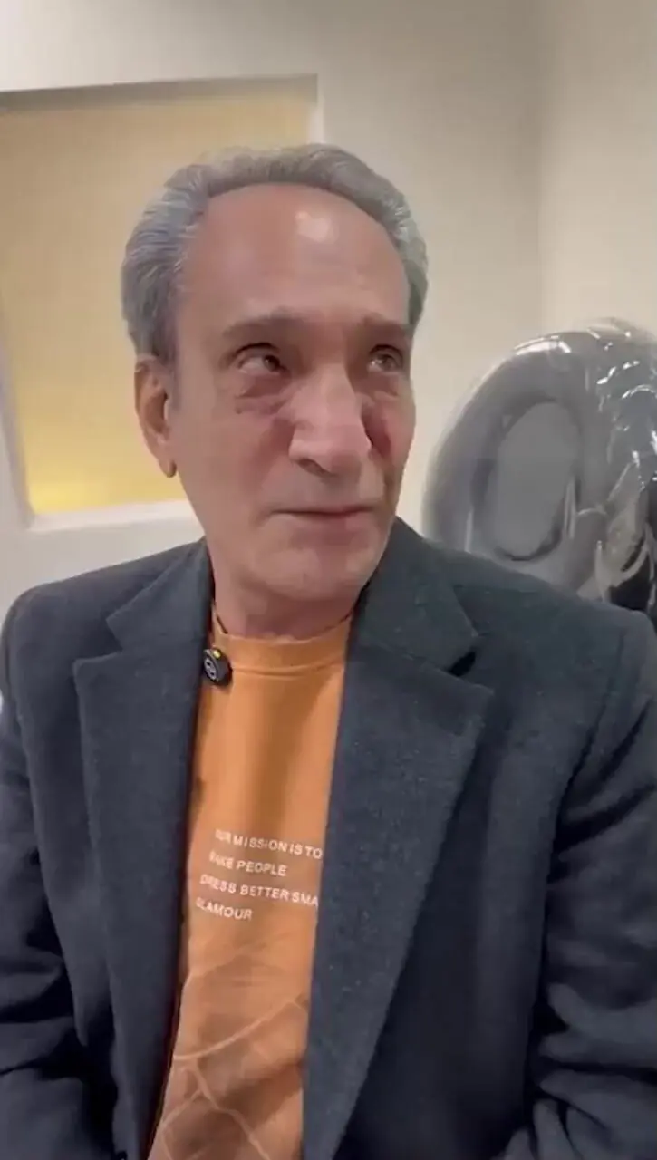 فیلم / خشایار راد بازیگر سریال خانه به دوش تغییر چهره داد و 20 سال جوان تر شد/ انگار کوبیده از نو ساخته ...