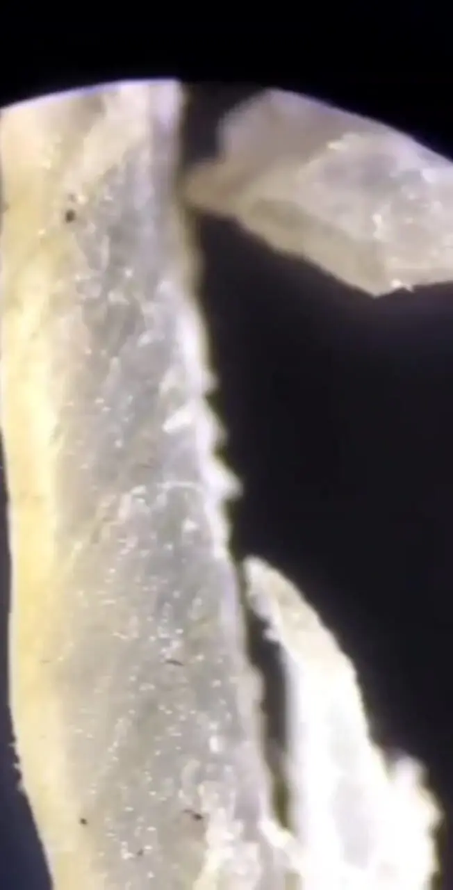 سفر به دنیای میکروسکوپی ناخن‌ها +  فیلم