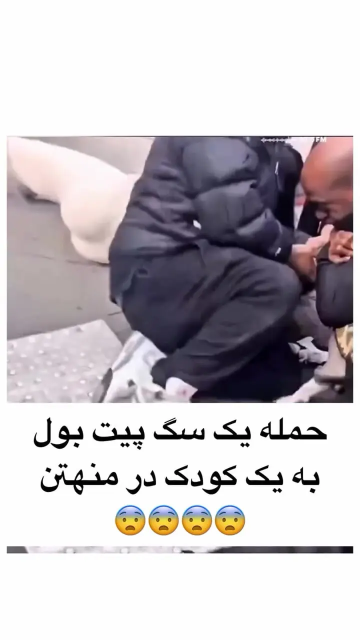 حمله سگ پیت بول به کودک خبرساز شد + فیلم