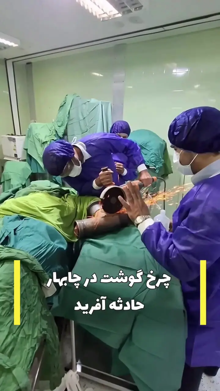 فیلم گیر کردن دست مرد جوان در چرخ گوشت / صحنه دردناک مقابل چشم آتش نشانان