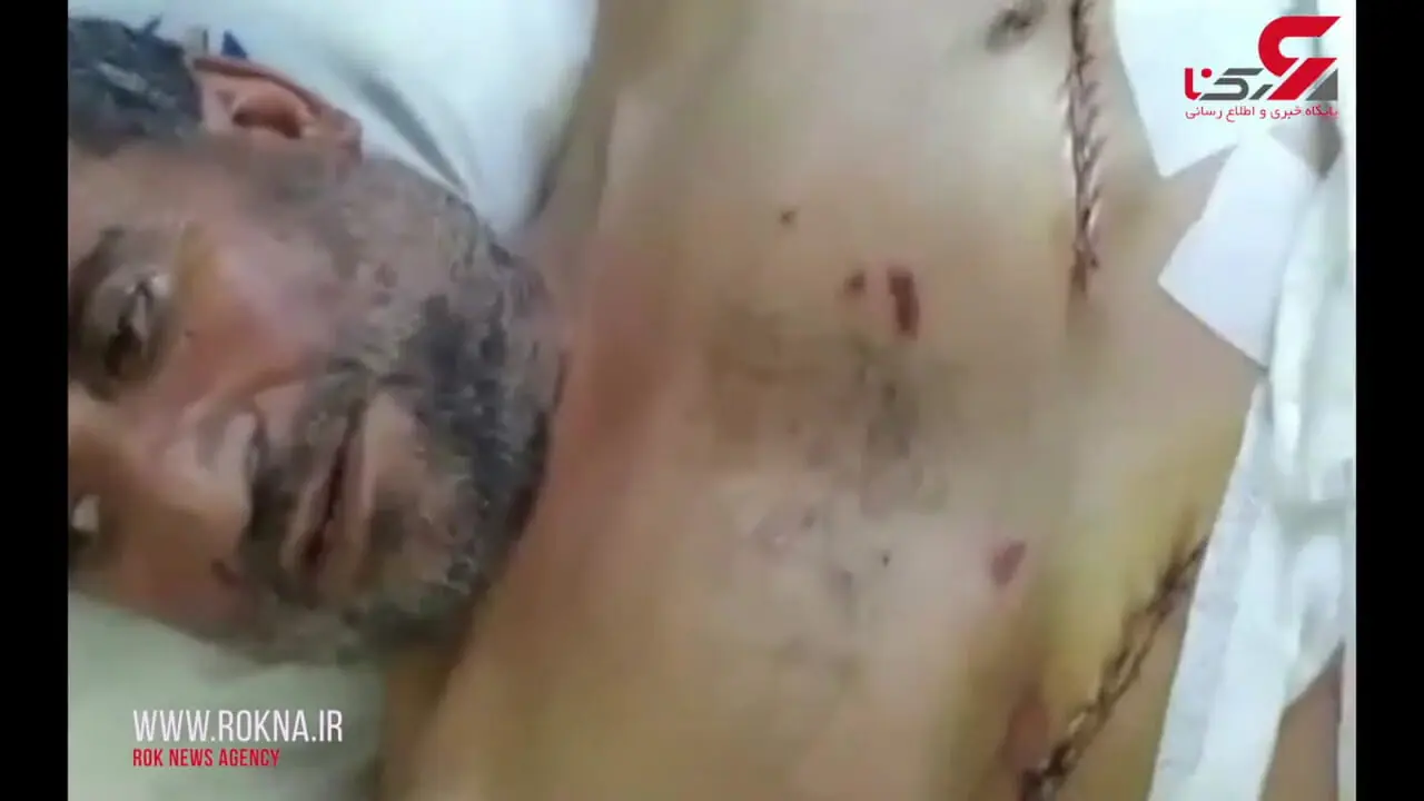  سینه سردار ایرانی را زنده زنده  شکافتند تا قلبش را  دربیاورند اما ....+  فیلم مخصوص بزرگسالان