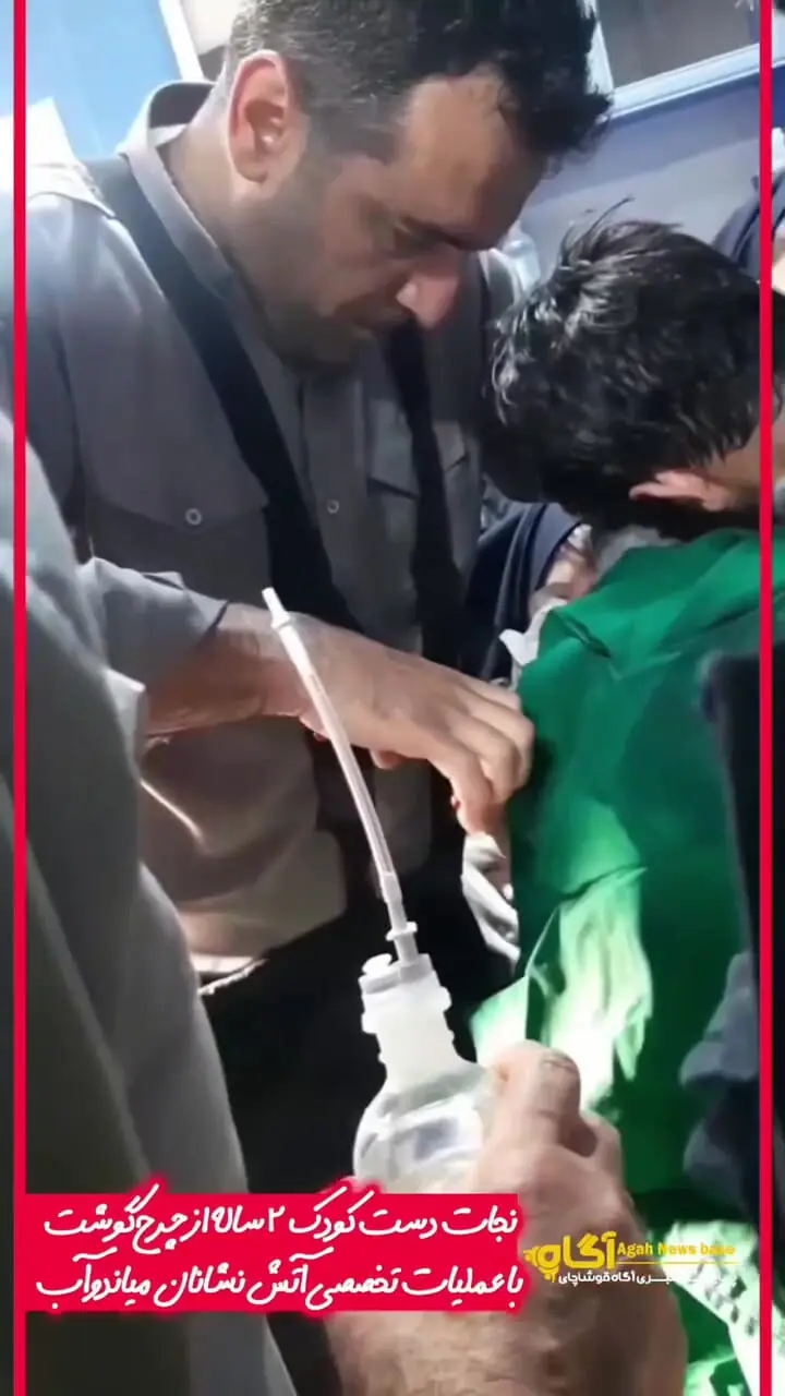 نجات دست کودک دو ساله از چرخ گوشت با عملیات تخصصی / کودکان را از وسایل برقی دور کنید