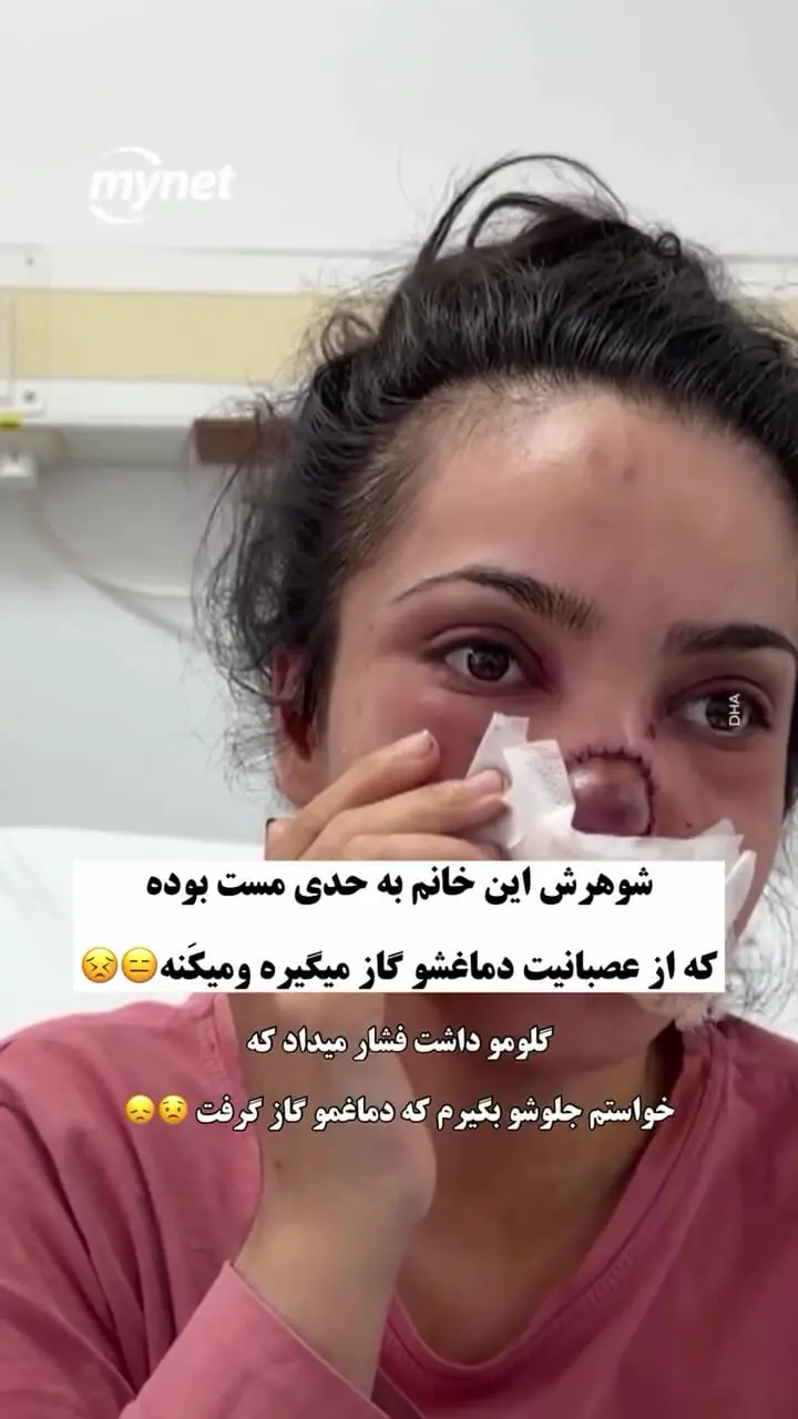 فیلم / شوهر این خانم  از عصبانیت دماغشو گاز گرفت و از جا کند