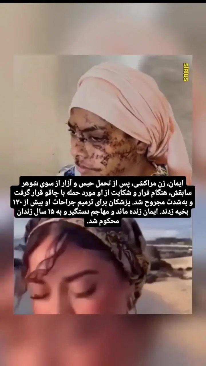 فیلم 130 بخیه بر صورت و دستان زن جوان /  شوهر سابقش صورت زیبای او را با چاقو خط خطی کرد